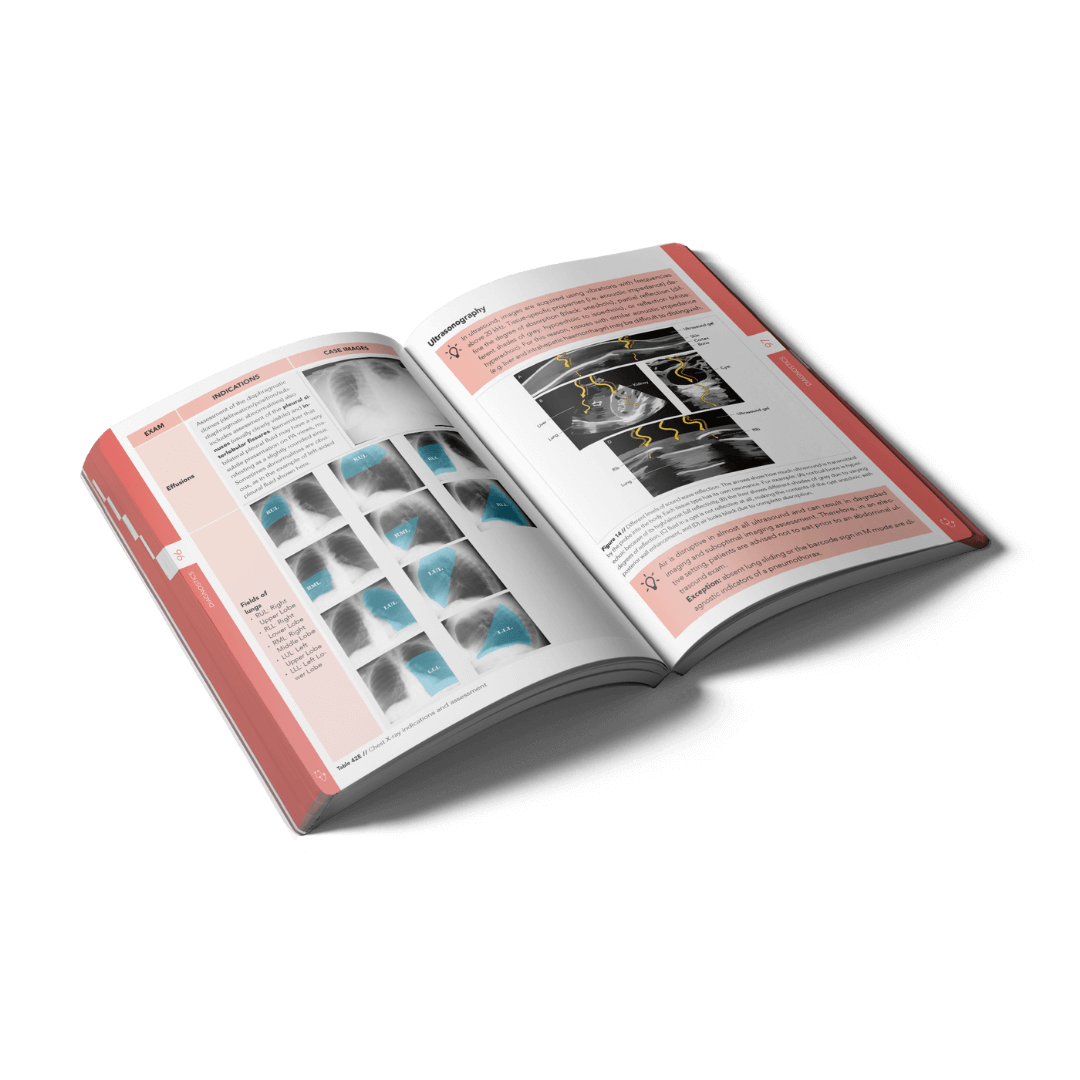 Open Acute Medicine book with clear layout, structured tables and visuals