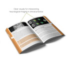 Open Neurology book with clear visuals for interpreting neurological imaging in clinical practice