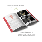 Open OB-GYN book with medical illustrations that assist in identifying important symptoms