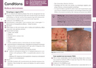 Preview of the Pocket Dermatology from the chapter conditions (pemphigus vulgaris)