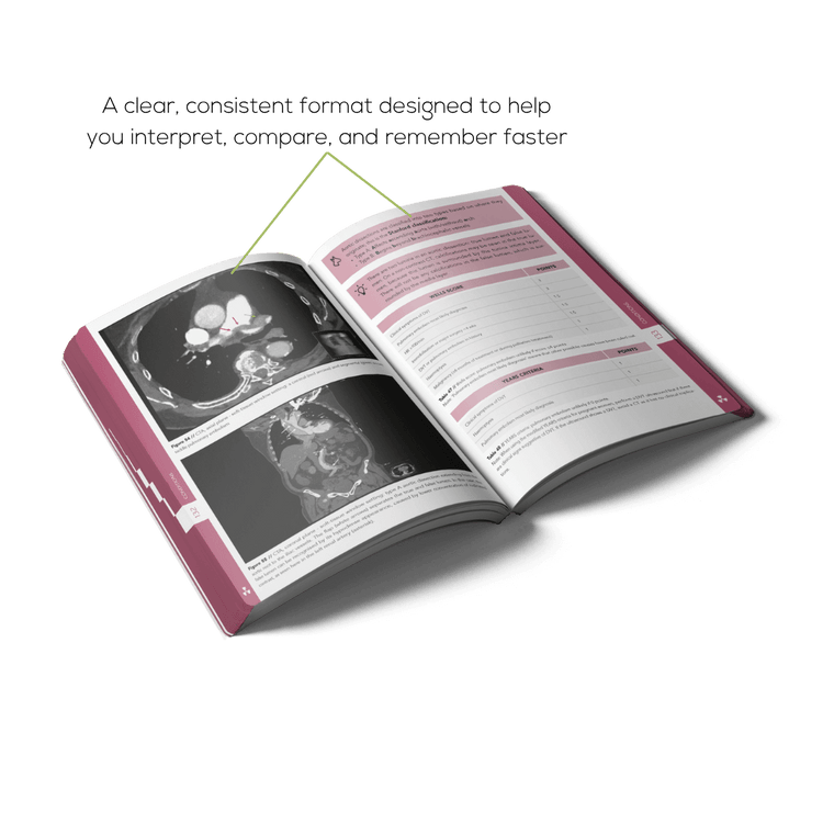 Open Radiology book with a clear structure, visuals, tables and mnemonics