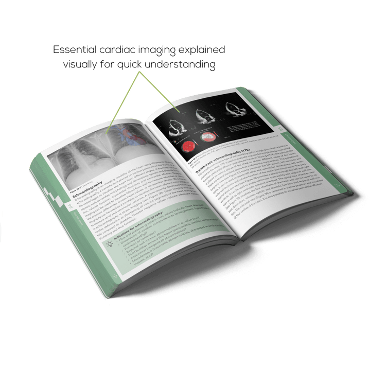 Open Cardiology book with cardiac imaging explained visually for quick understanding