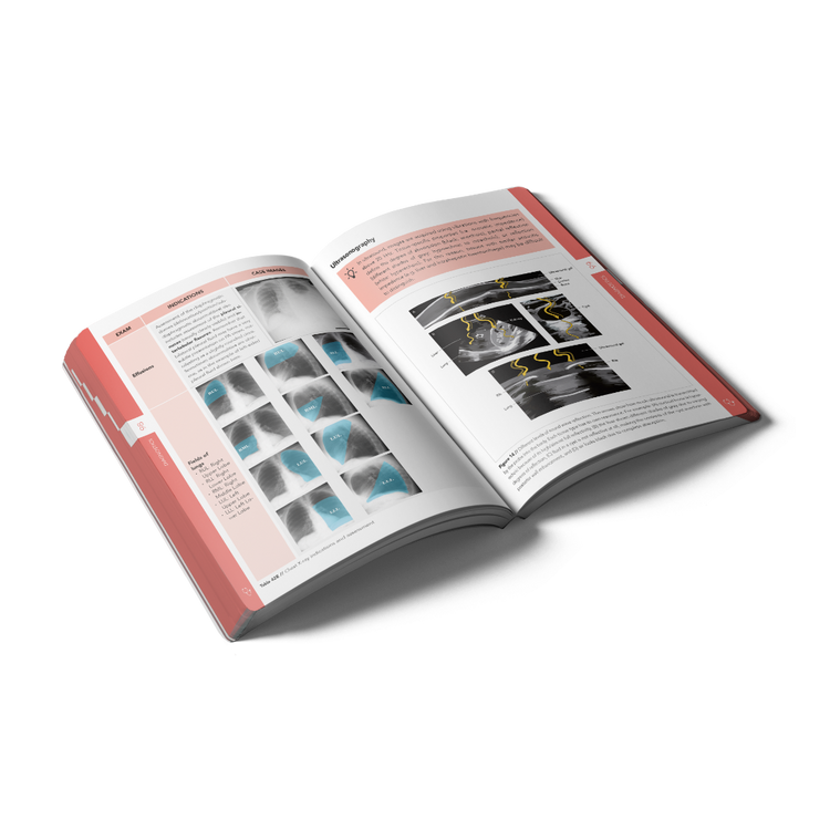 Compendium Medicine pocket Acute Medicine mockup inside pages