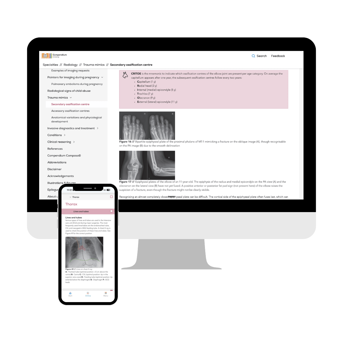 Radiology (Online Subscription) – Compendium Medicine