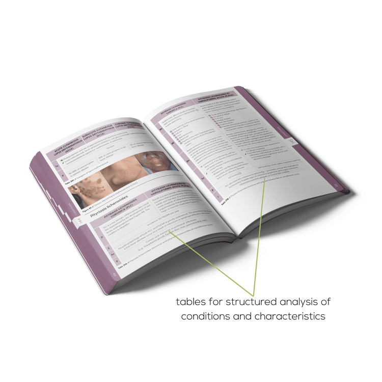 Open Dermatology book with tables for structured analysis