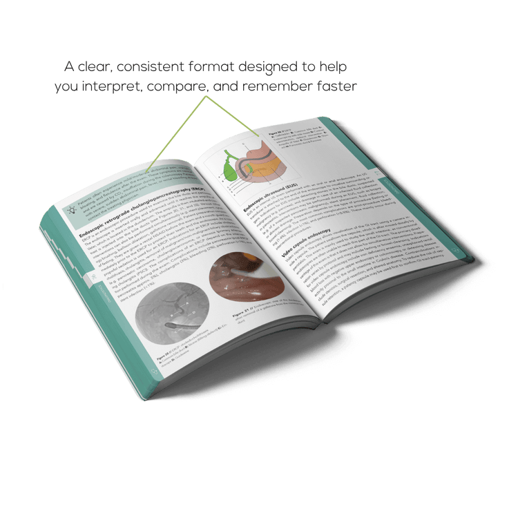 Open Gastroenterology and Hepatology book with illustrations and a clear structure