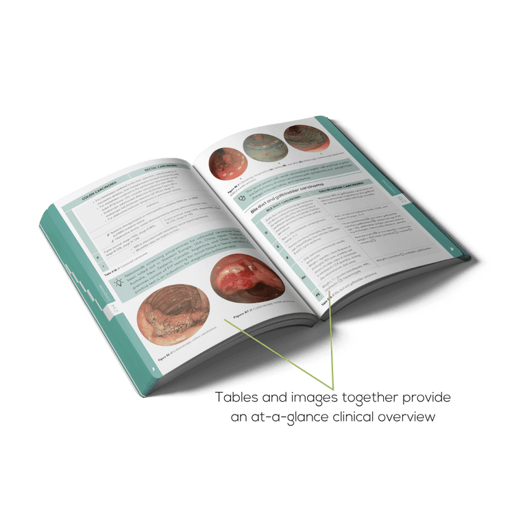 Open Gastroenterology and Hepatology book with illustrations and clear tables
