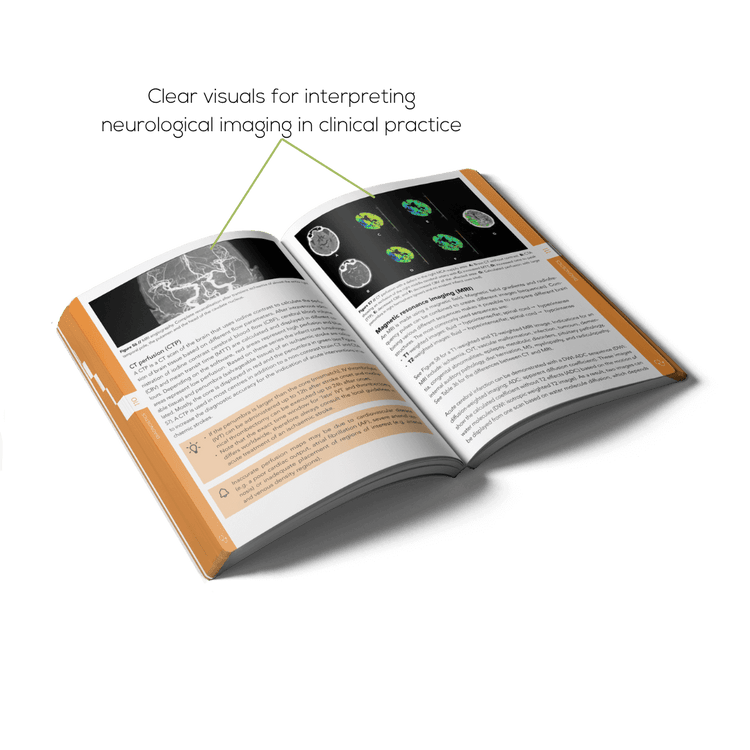 Open Neurology book with clear visuals for interpreting neurological imaging in clinical practice