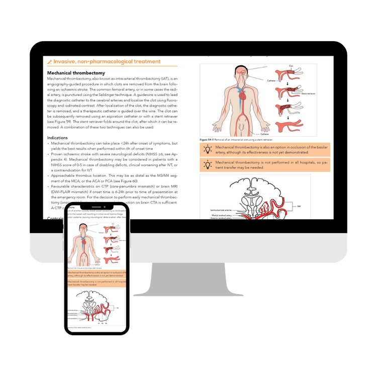 Pre-order Neurology (Online Subscription)