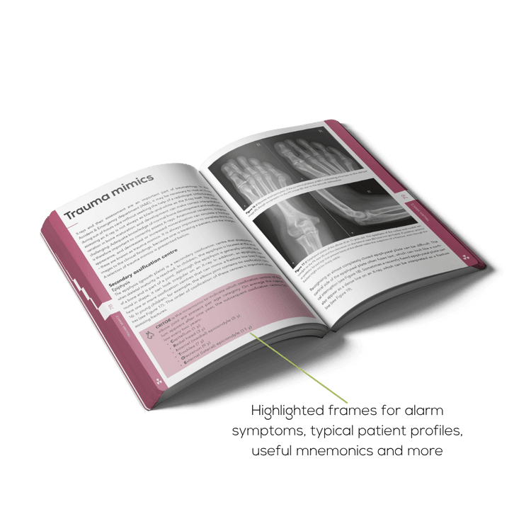 Open Radiology book with a clear structure, visuals and mnemonics