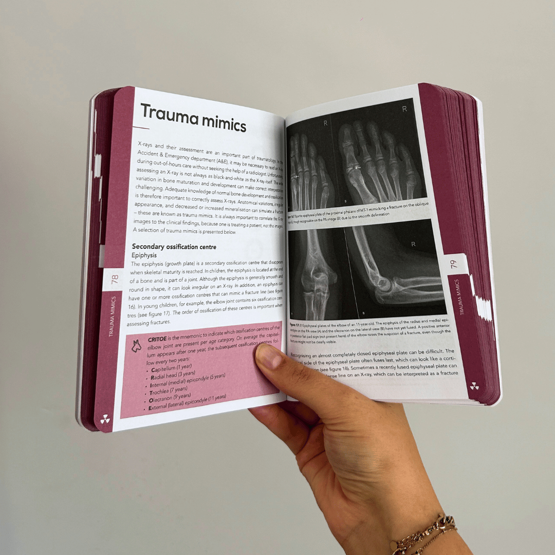 Radiology pocket inside - trauma mimics