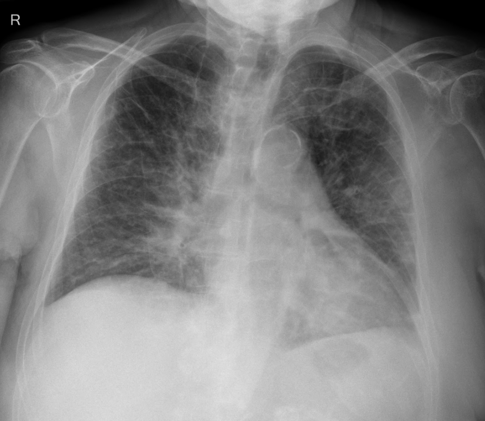 Free Radiology Quiz Test Your Knowledge Compendium Medicine