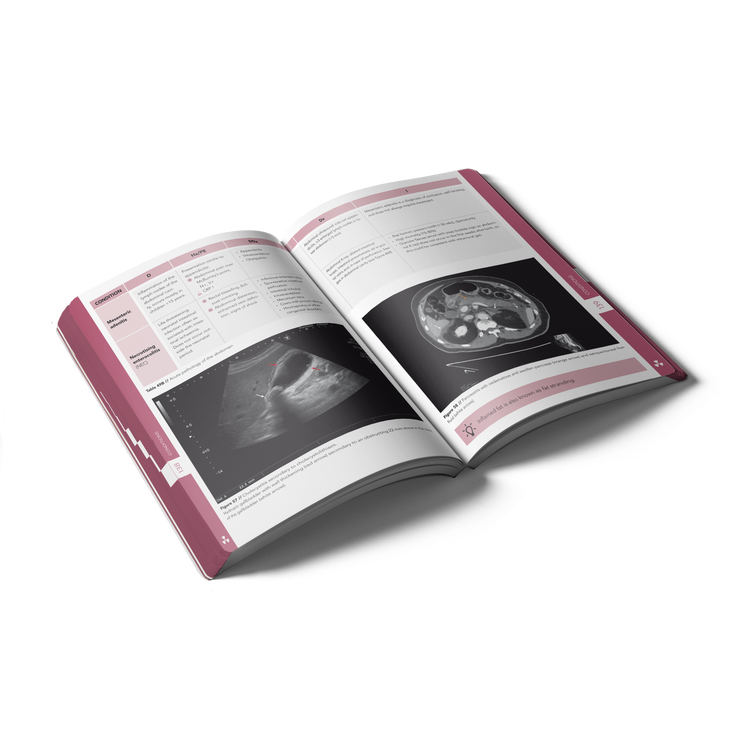 preview open book pocket radiology 