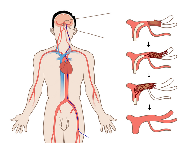 Pocket Radiology (2023) – Compendium Medicine